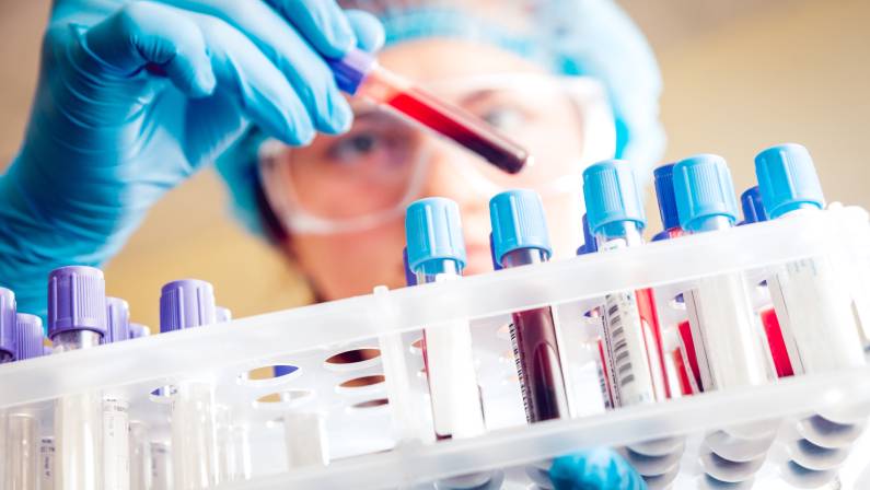 Medical tests before neck lift surgery