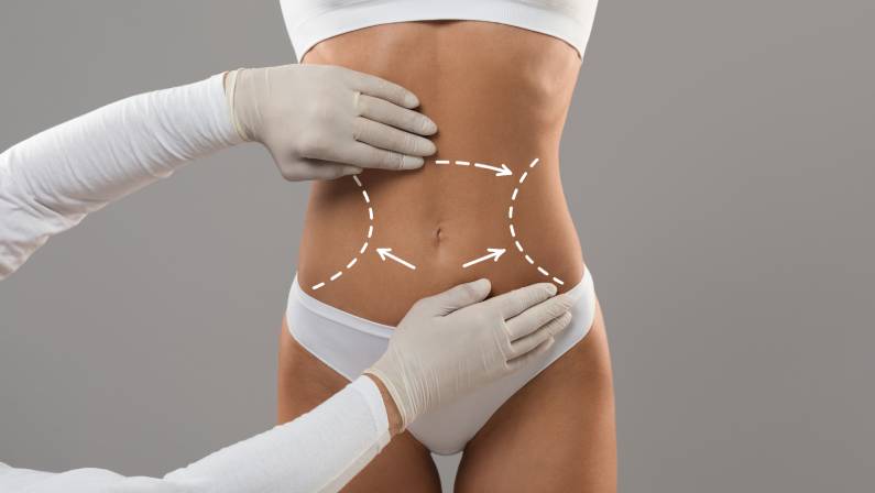 Body Contouring Concept