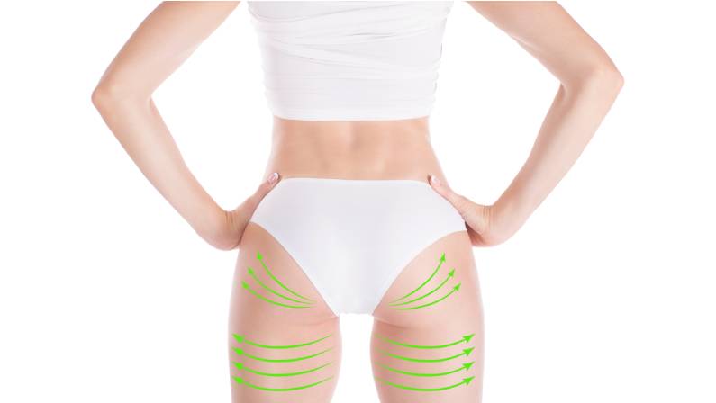 Lifting marking with green arrows in womans hips and legs