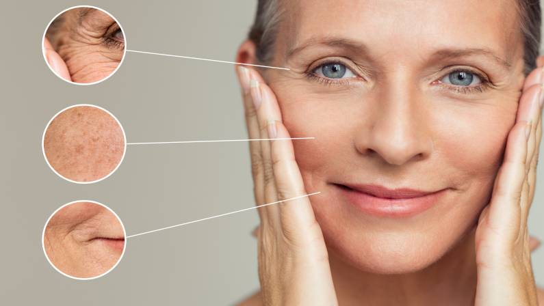 Close ups of wrinkles and skin imperfection on the face of a senior woman.