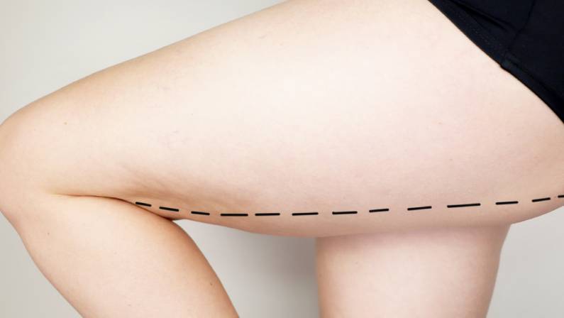 Patient on consultation with a plastic surgeon