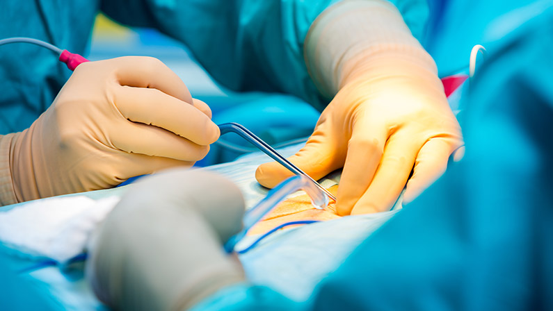 Surgeons hands with sterile, protective gloves after skin incision.