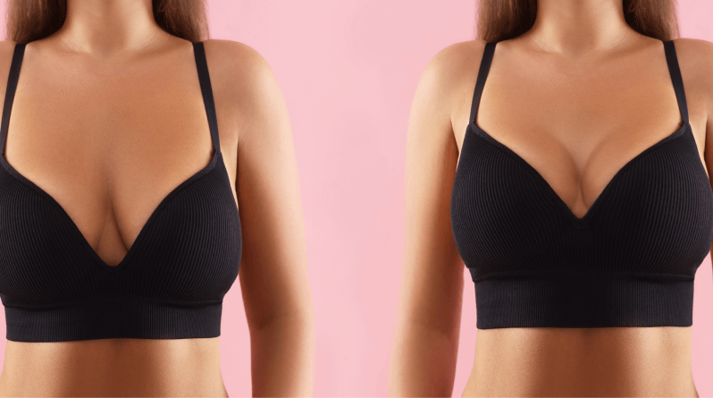 How Much Does a Mastopexy Cost