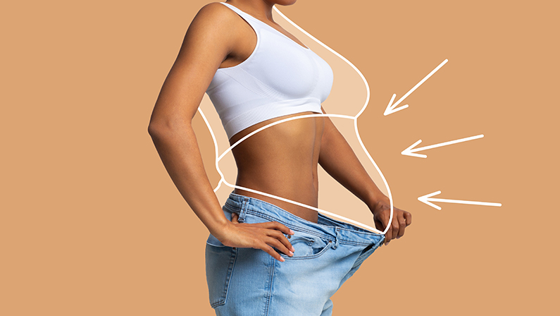 Woman showing slimmer waistline after surgery, illustrating effective body contouring and Recovery Time for Liposuction.