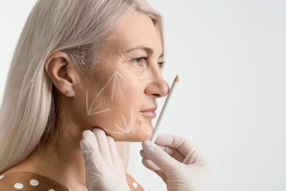Specialist marking facial areas on a woman’s face to plan a Liquid Facelift for smoother, youthful-looking skin.