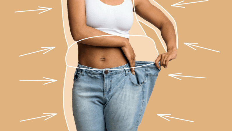 Woman showing slimmer waistline after Liposuction Surgery, highlighting noticeable fat reduction and body contouring.