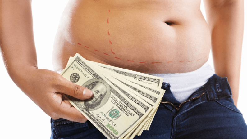 Person holding money near stomach with surgical marks, considering Liposuction Surgery cost and treatment options.