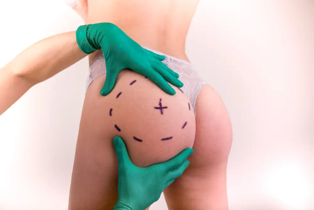 Surgeon drawing marks on female body before plastic operation, white background.