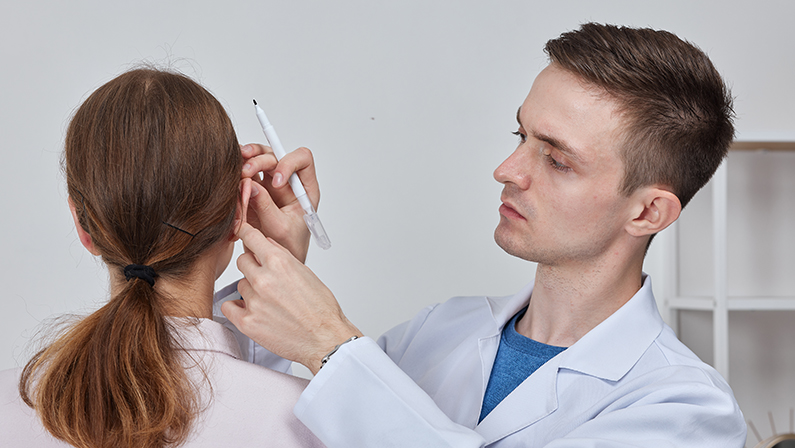 Otoplasty markup for surgical reshaping of the pinna, or outer ear for correcting an irregularity and improving appearance. Surgeon doctor marking girl ear before otoplasty cosmetic surgery