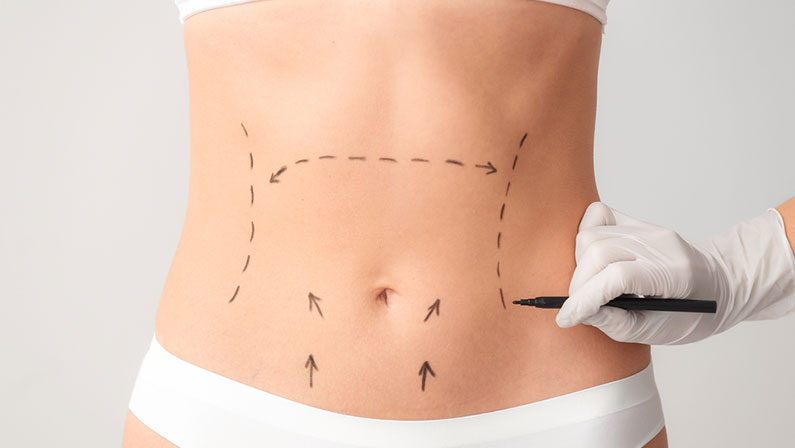 Plastic surgeon applying marks on female body against light background