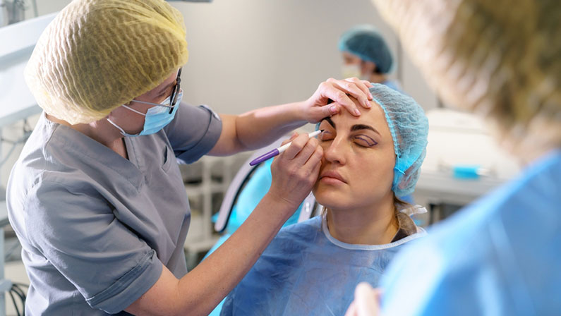 Blepharoplasty plastic surgery. Rejuvenation and modification of the area around the eyes. Plastic surgeon applies markings to the patient