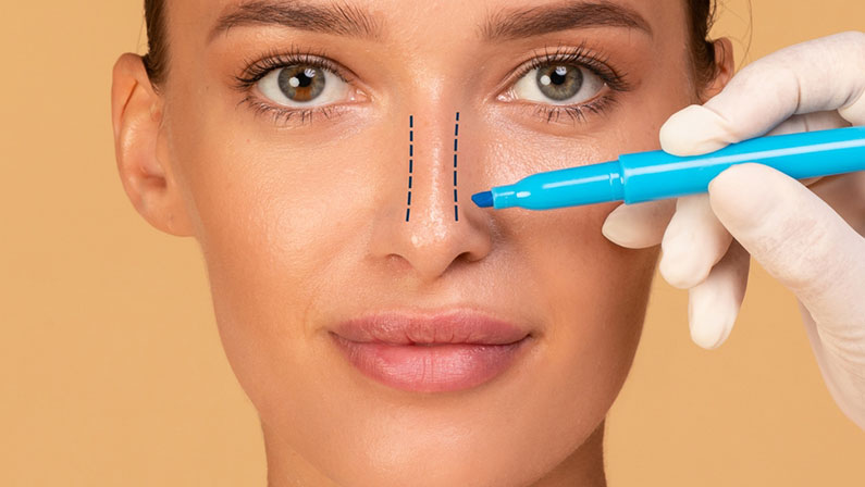Rhinoplasty concept. Young woman with marking on her nose on beige studio background, closeup. The doctor's gloved hand making marks on the patient's face