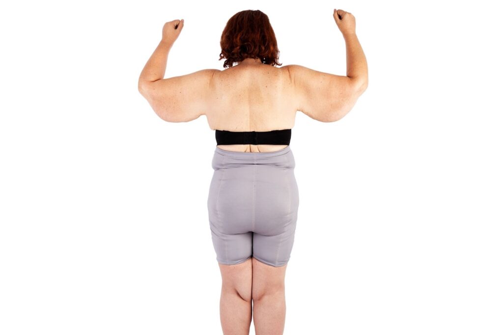 Mommy Makeover Recovery Timeline