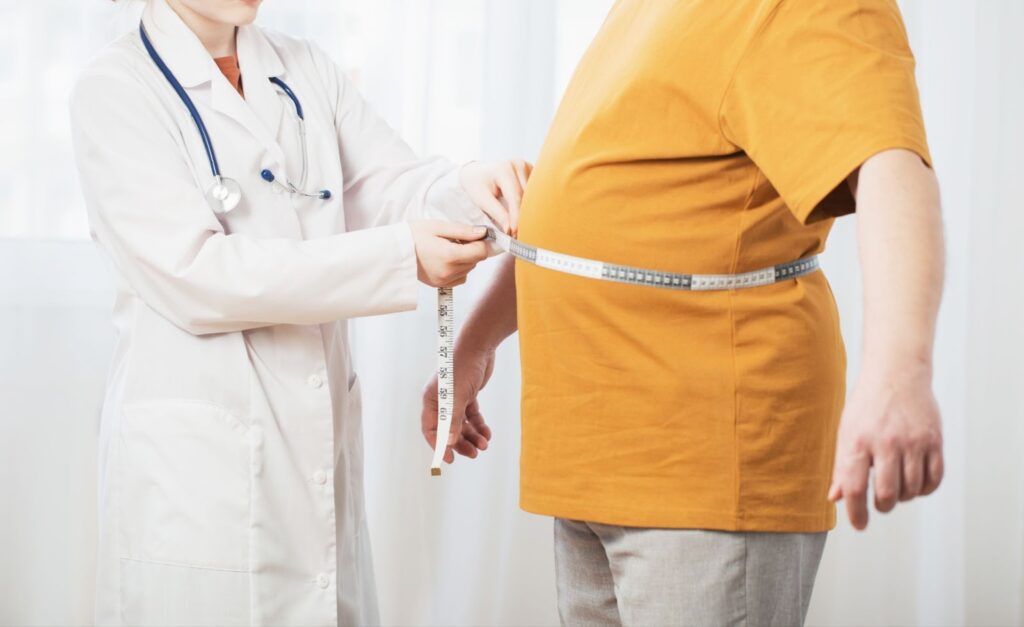 Liposuction for Men