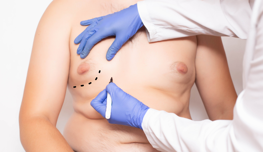 Plastic surgeon preparation before surgery to reduce breasts in men