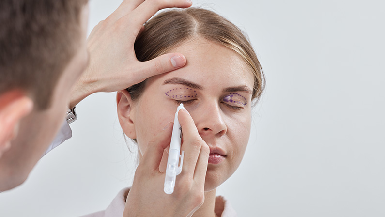 Doctor drawing eyelid lines to plan blepharoplasty stitches placement for precise upper eyelid lift procedure.