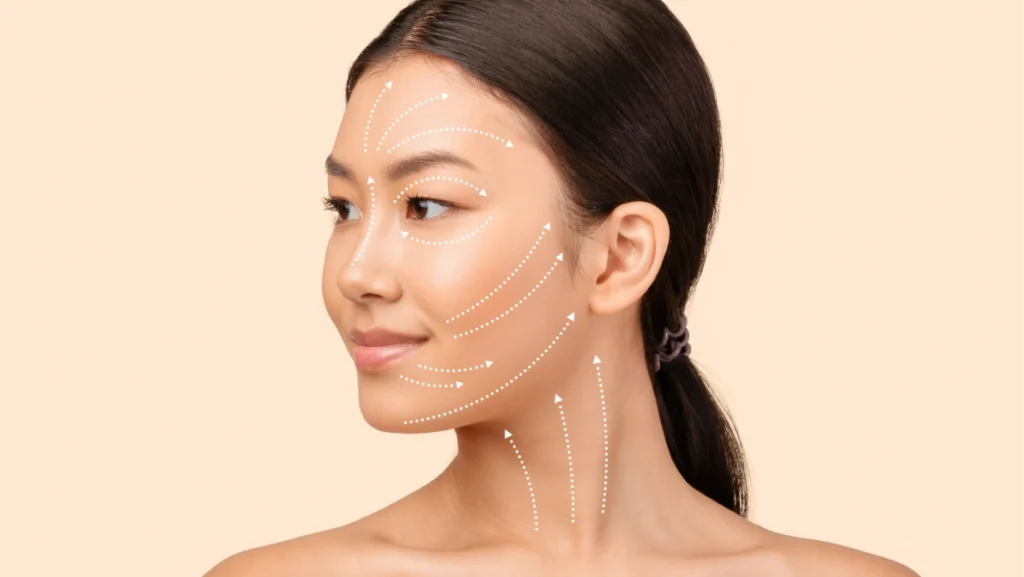 Woman with facial contour lines showing lifting areas before mini facelift treatment for youthful skin improvement.