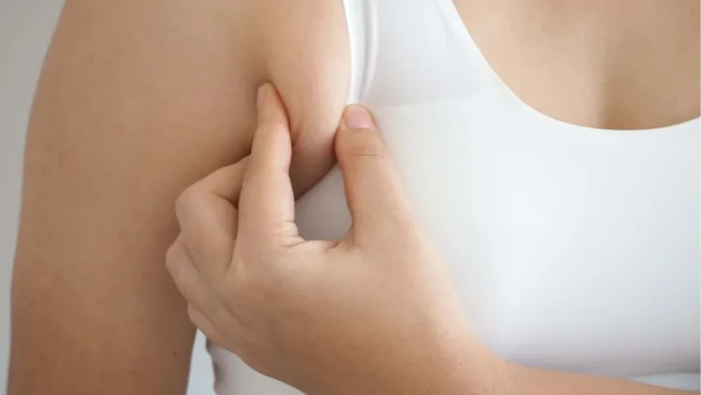 Armpit Fat Removal