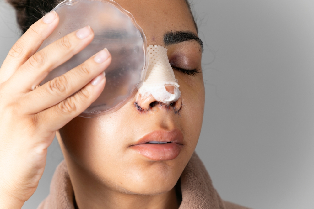 Young woman after aesthetic rhinoplasty procedure with ice pack