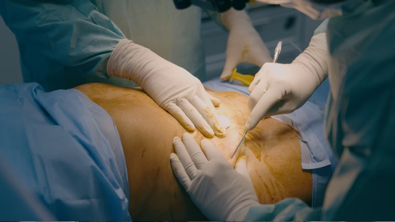 Two doctors men surgeon physician medic help patient operate plastic surgery abdomen belly liposuction inject anesthesia medical syringe health emergency medicine surgical operation at hospital clinic