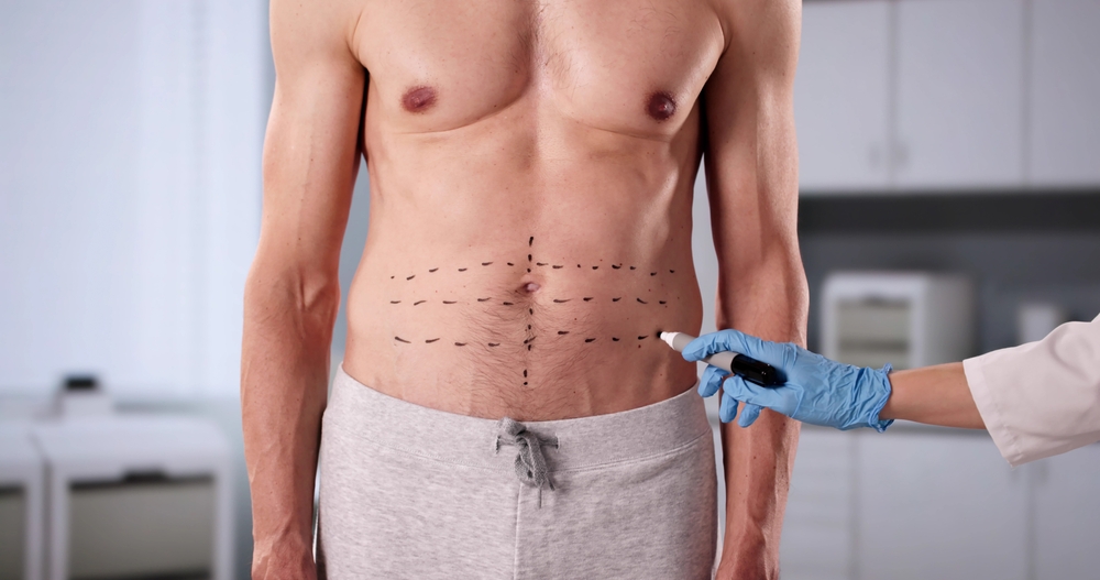 Transformation Through Aesthetic Plastic Surgery