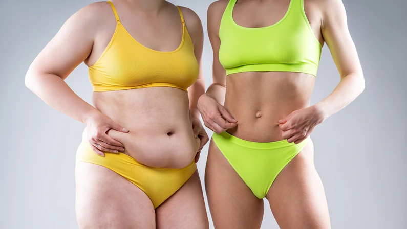 Before after weight loss, tummy tuck, fat and thin women with flabby and muscular bellies on gray studio background, plastic surgery and body positive concept