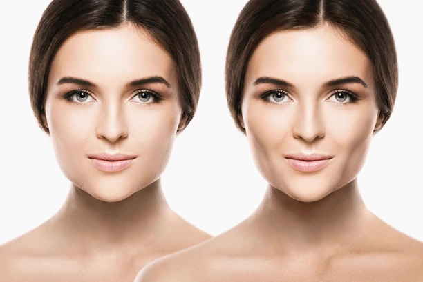 Female face comparison after successful buccal fat extraction plastic surgery